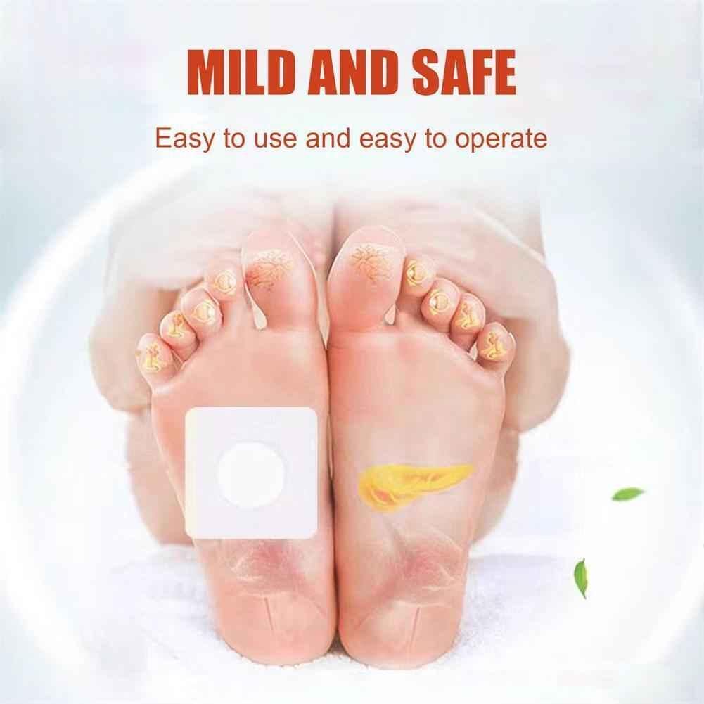 Acupoint Pressure Stimulation, Sugar Control Acupoint Sticke
