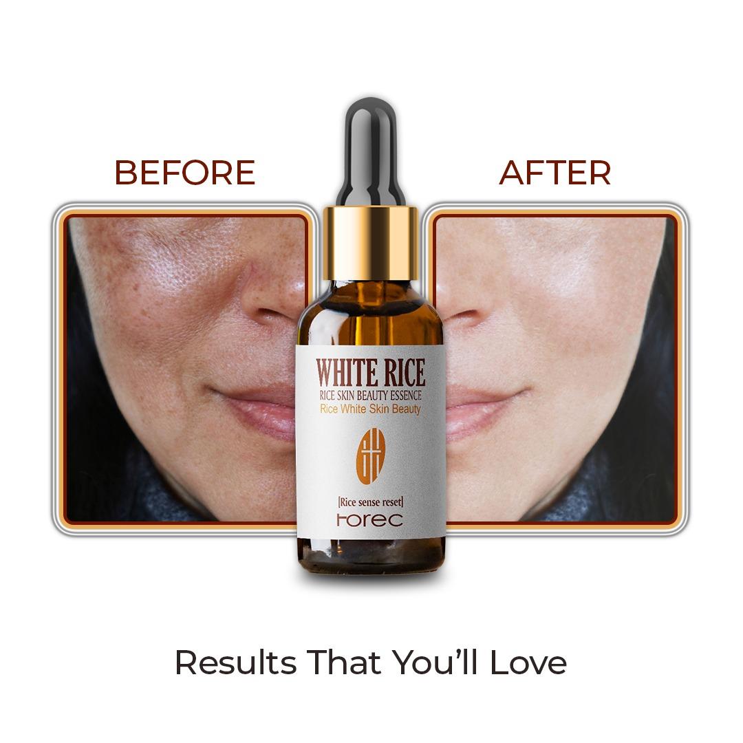 White Rice face serum reduces wrinkles Corrector 30 ml Each (Pack Of 2)