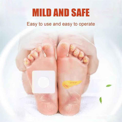 Acupoint Pressure Stimulation, Sugar Control Acupoint Sticke