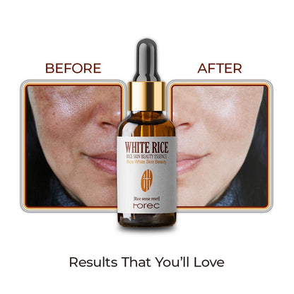 White Rice face serum reduces wrinkles Corrector 30 ml Each (Pack Of 2)